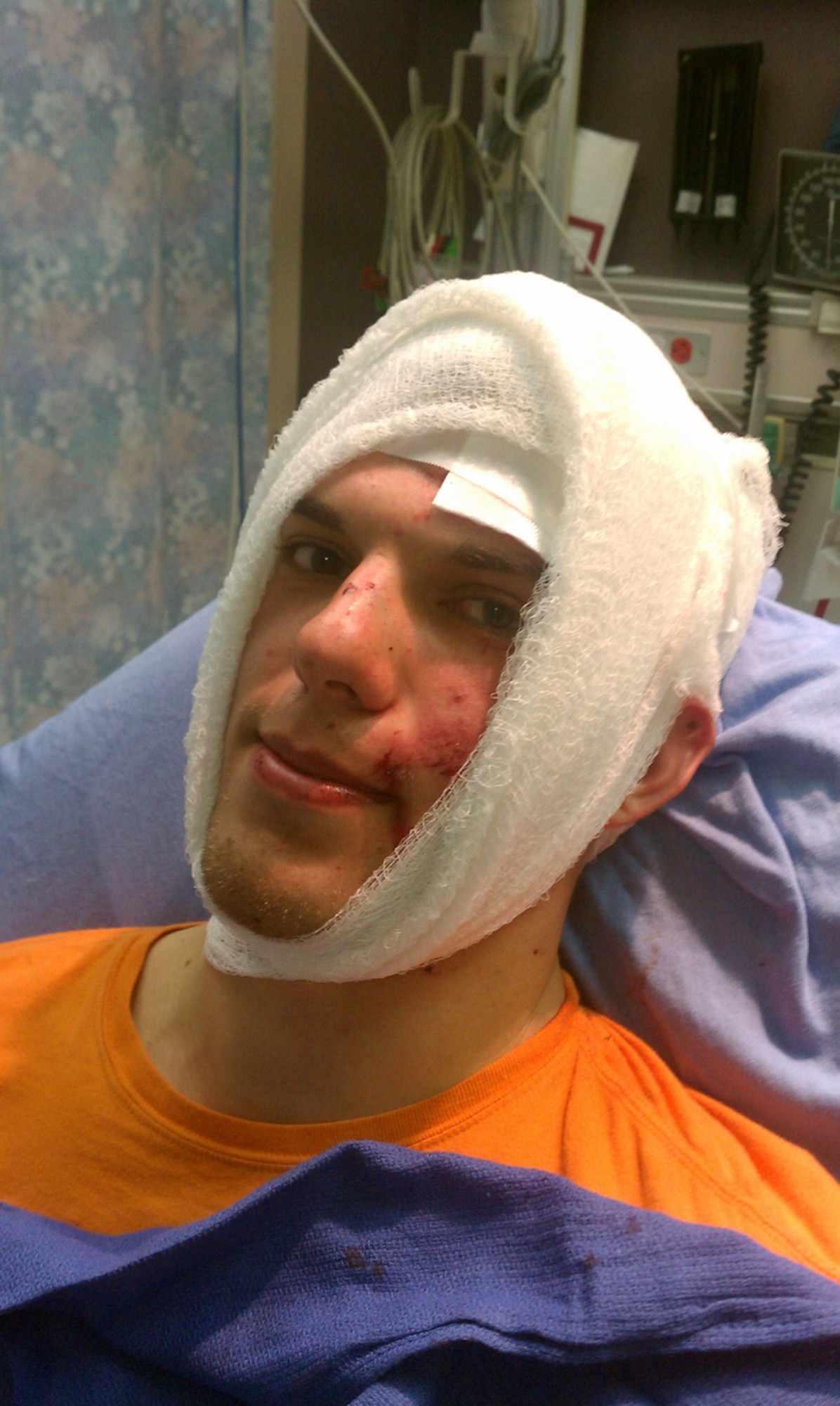 SCALPED! BICYCLIST INJURES HEAD AFTER CRASHING THROUGH VAN WINDOW - Brad Sturch waits in the emergency room after being rushed to the hospital following a bicycle crash. He needed 50 stitches to sew his scalp back on; he hadn’t been wearing a helmet. (Courtesy Photo)