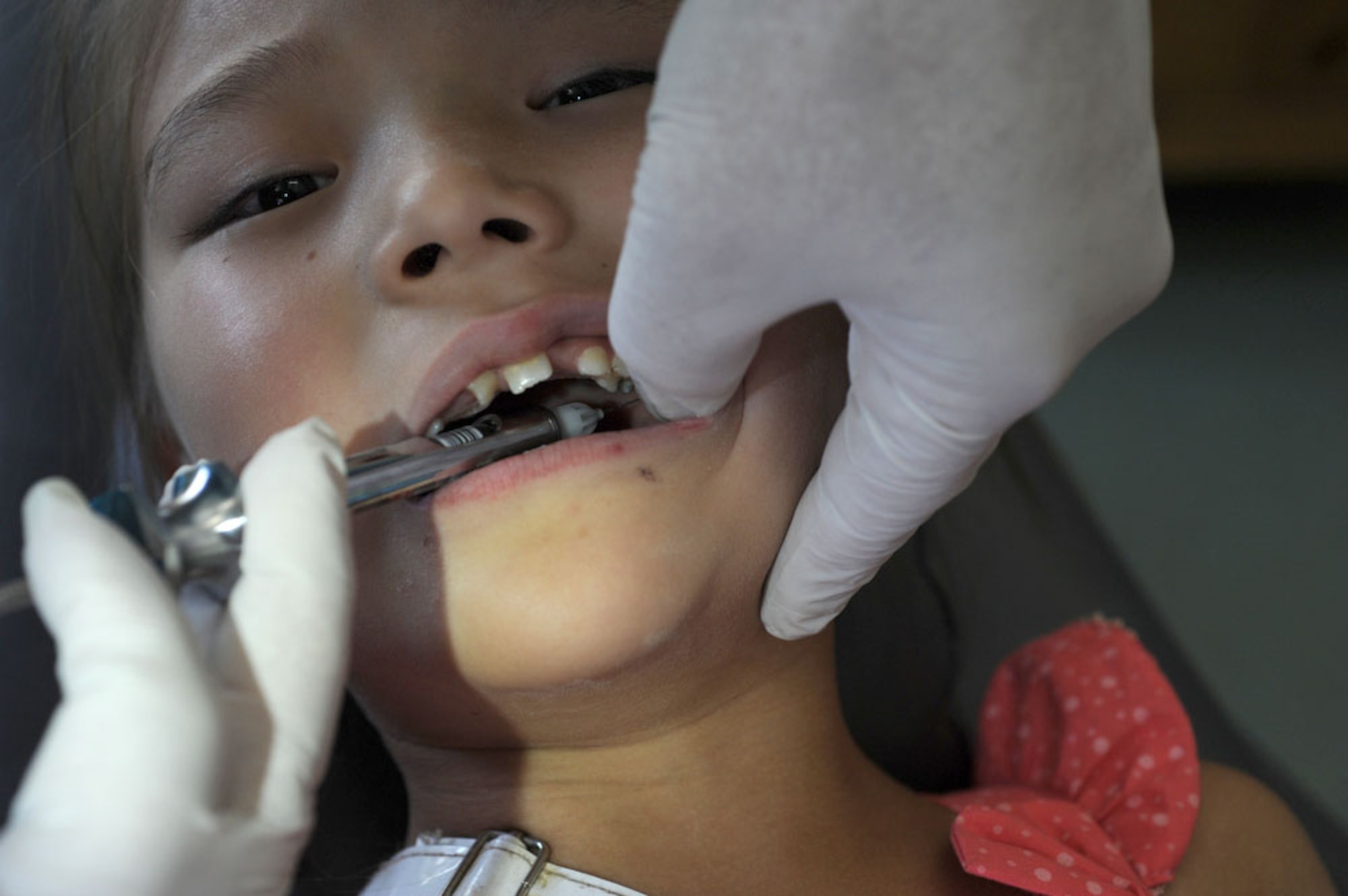 ULAANBAATAR, Mongolia - A young Mongolian girl has her tooth pulled at the Buynt Uhaa Complex in Ulaanbaatar, Mongolia on Aug. 9 during Khaan Quest 2011, a combined joint-exercise hosted by the Mongolian Armed Forces in partnership with U.S. Pacific Command forces. Medical Civil Action Programs like this enable the countries involved to become familiar with one another in addition to helping the community of the host country.  Khaan Quest officially started July 31 and continues until Aug 12. (U.S.  Air Force photo/Master Sgt. Cohen A. Young)