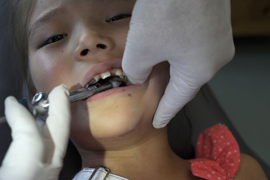 ULAANBAATAR, Mongolia - A young Mongolian girl has her tooth pulled at the Buynt Uhaa Complex in Ulaanbaatar, Mongolia on Aug. 9 during Khaan Quest 2011, a combined joint-exercise hosted by the Mongolian Armed Forces in partnership with U.S. Pacific Command forces. Medical Civil Action Programs like this enable the countries involved to become familiar with one another in addition to helping the community of the host country.  Khaan Quest officially started July 31 and continues until Aug 12. (U.S.  Air Force photo/Master Sgt. Cohen A. Young)