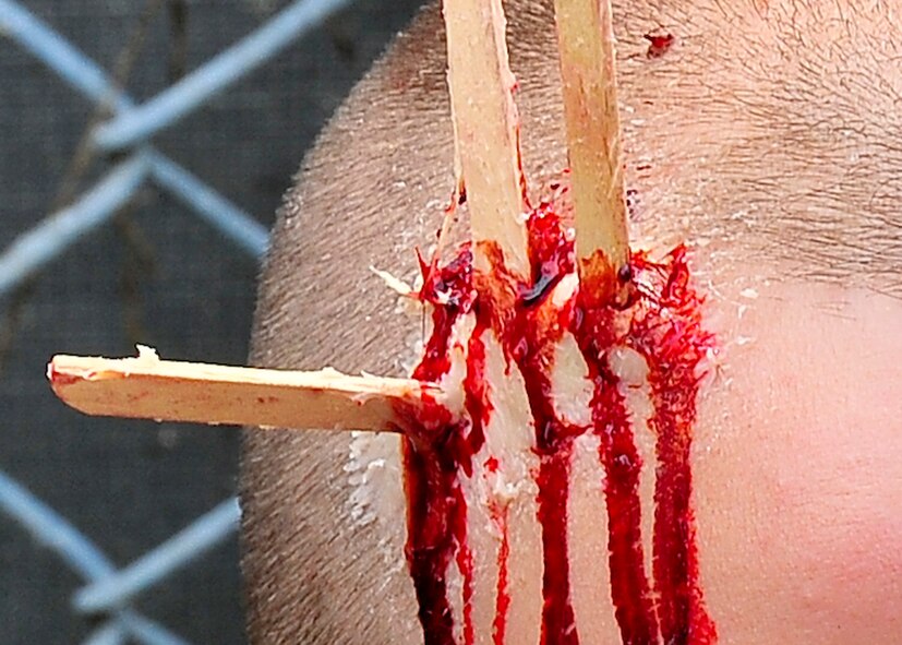 Moulage is used to simulate an injury during a mass causality collection Aug. 30, 2011, during exercise Beverly-Midnight 11-04. Exercises, such as this, sharpen Osan's ability to survive and operate during combat. (U.S. Air Force photo/Senior Airman Adam Grant)  