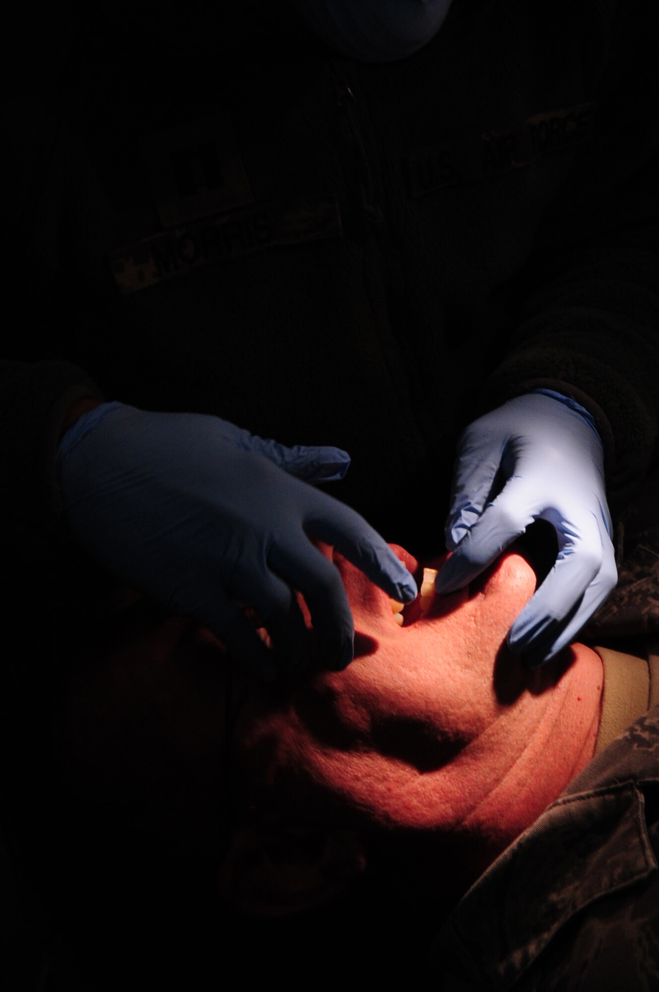 Staff Sgt. Geantel Ovalle-Escobar, 86th Medical Group dental technician, checks a patient for a chipped tooth during an expeditionary Medical Support Exercise, Ramstein Air Base, Dec. 01, 2011. EMEDS was a week-long exercise for the 86th and 31st Medical Group to hone their skills in a mock-deployed environment. (U.S. Air Force photo by Senior Airman Aaron-Forrest Wainwright)