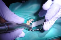 Capt. Jonathan Norris drills a loose cavity during a refill cavity procedure on Seymour Johnson Air Force Base, N.C., Dec. 7, 2011. The 4th Aerospace Medicine Squadron (AMDS) dental clinic performs more than 100 cavity fills and refills monthly. Norris is a 4 AMDS dentist from Virginia Beach, Va. (U.S. Air Force photo by Senior Airman Whitney Stanfield) 
