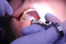 Capt. Jonathan Norris prepares to administer lidocaine into the gums of a patient during a refill cavity procedure on Seymour Johnson Air Force Base, N.C., Dec. 7, 2011. Lidocaine is a numbing liquid used prior to dental work. Norris is a 4th Aerospace Medicine Squadron dentist from Virginia Beach, Va. (U.S. Air Force photo by Senior Airman Whitney Stanfield) 
