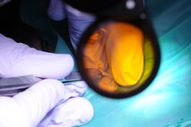 Capt. Jonathan Norris adds a wedge between the teeth of a patient during a refill cavity procedure on Seymour Johnson Air Force Base, N.C., Dec. 7, 2011. Wedges are used to push teeth apart in tight areas so a band can be added to hold teeth in place during procedure. Norris is a 4th Aerospace Medicine Squadron dentist from Virginia Beach, Va. (U.S. Air Force photo by Senior Airman Whitney Stanfield) 