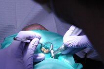 Capt. Jonathan Norris uses a mouth mirror during a refill cavity procedure on Seymour Johnson Air Force Base, N.C., Dec. 7, 2011. Mouth mirrors are used to provide a better visual aide in areas that are normally hard to see for the dentists. Cavities take nearly a year to develop on a tooth. Norris is a 4th Aerospace Medicine Squadron dentist from Virginia Beach, Va. (U.S. Air Force photo by Senior Airman Whitney Stanfield) 