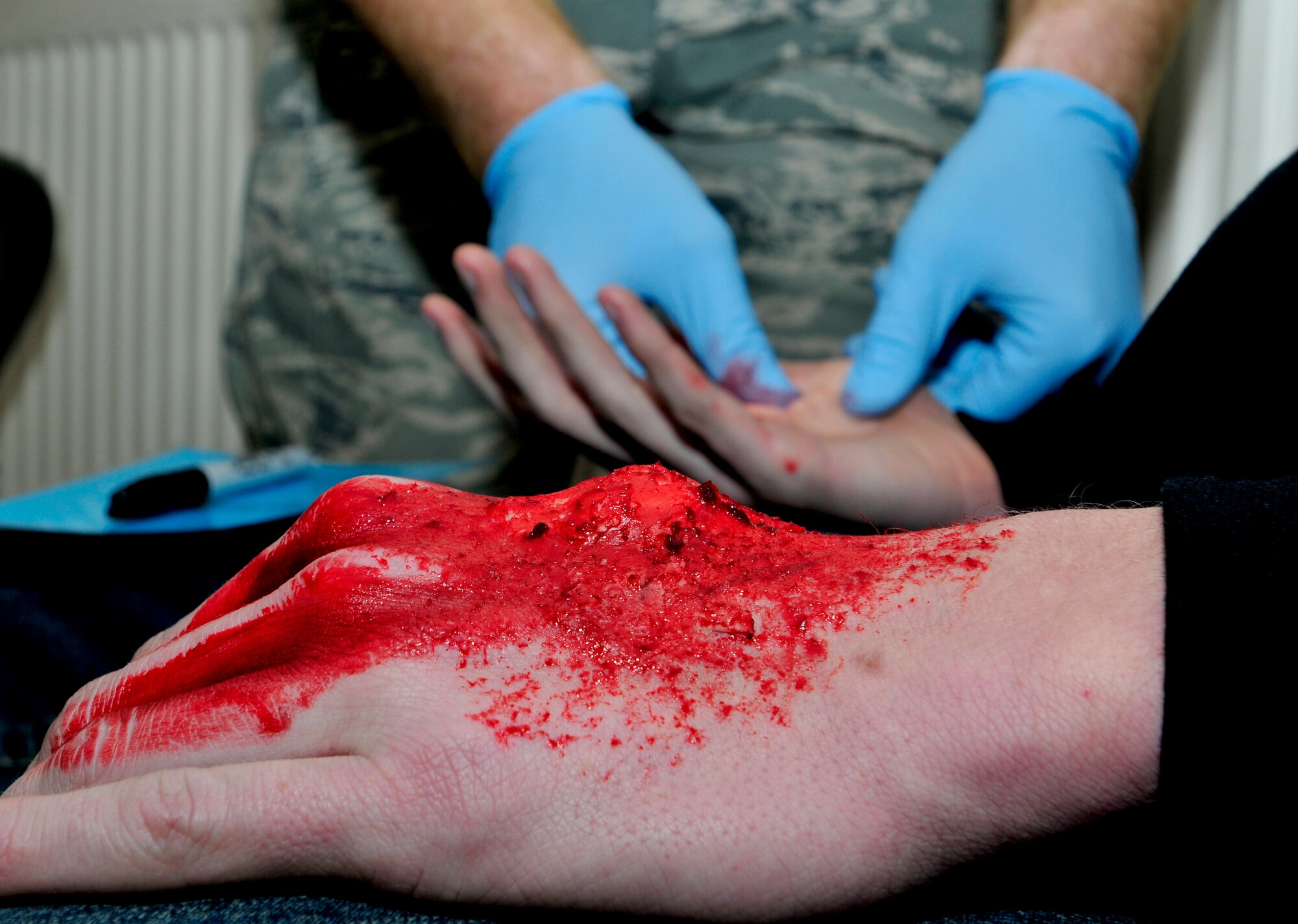 ROYAL AIR FORCE FELTWELL, England - Tech. Sgt. Nicholas Hauxwell, 48th Medical Surgical Squadron NCO in charge of surgical services, applies moulage to the hands of Airman 1st Class John Griffin, 48th Maintenance Squadron Avionics technician, during an exercise, Dec. 8, 2011. The 48th Medical Group hosted a week-long mobile Expeditionary Medical Support course at RAF Feltwell to keep their readiness capabilities sharp in a mock-deployed environment. (U.S. Air Force photo by Senior Airman Tiffany M. Deuel