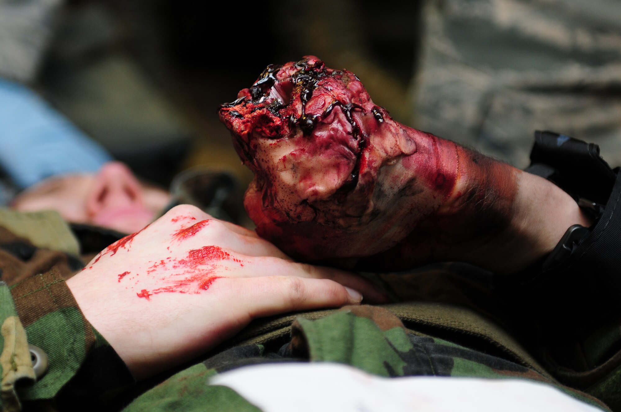 ROYAL AIR FORCE LAKENHEATH, England - A victim from a simulated attack waits for medical assistance during the NATO Tactical Evaluation, Dec. 15, 2011. Moulage was used to make the training as realistic as possible to better prepare the Airmen for real world scenarios. The exercise measured the 48th Fighter Wing's ability to respond to a contingency situation. (U.S. Air Force photo by Senior Airman Lausanne Morgan)