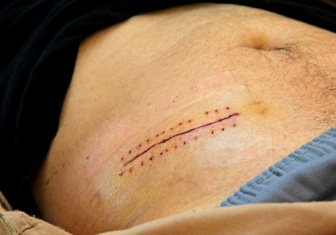 Samd Mamhd, a student at the Joint Security Academy Southwest aboard Camp Leatherneck, lifts up his shirt to allow Petty Officer 1st Class Terry Gray, JSAS's Senior Medical Department Representative, to examine his stitches, April 27. JSAS corpsmen were able to quickly diagnose Mamhd with appendicitis and transport him to the nearest medical facility for treatment, essentially saving his life, April 16. 