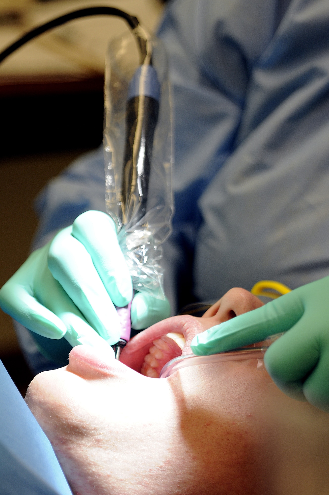 Good daily oral hygiene is key to prevent the build-up of plaque. Plaque causes two of the most common diseases found in the mouth, dental decay and gum disease. Sailors at Joint Base Charleston-Weapons Station are seen annually for a routine examination and scheduled cleaning at Naval Health Clinic Charleston Dental. (U.S. Navy photo/Mass Communication Specialist 1st Class Jennifer Hudson) 