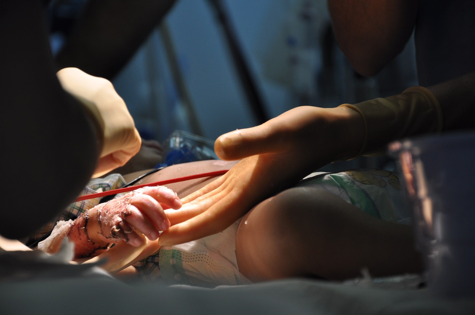 An Airman at the Craig Joint Theater Hospital repositions the hand of a 12-month-old Afghan boy during a procedure in the operating room. The boy was brought to the hospital with significant burns from a propane tank explosion at his home in Kapisa Province.  (U.S. Air Force photo by Capt. Erick Saks)