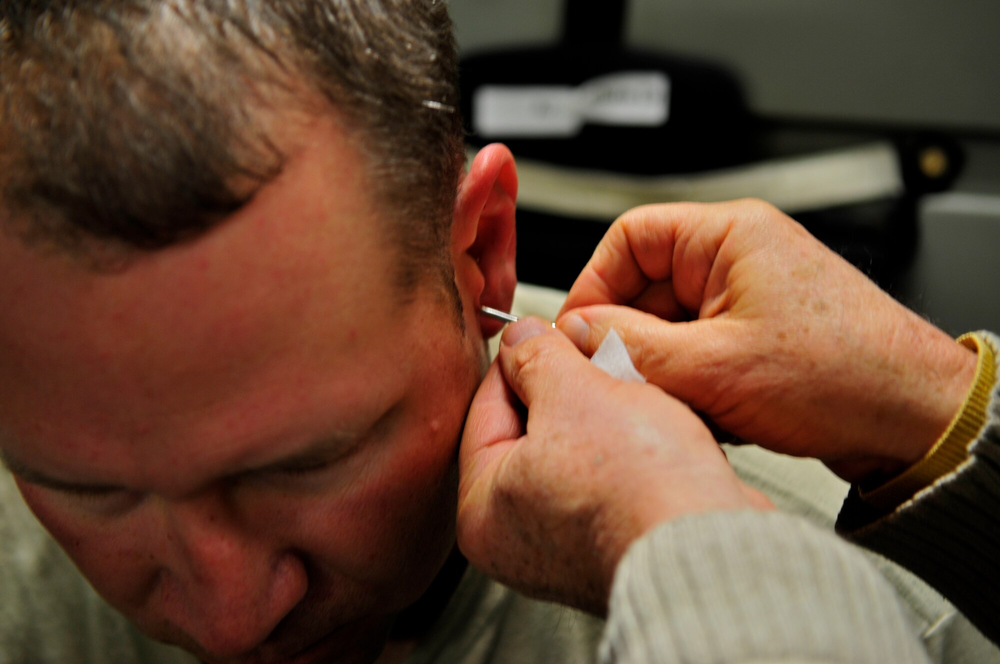 Dr. Niemtzow removes acupuncture needles from a U.S. Army soldier’s ears aboard an AE flight from Ramstein Air Base Germany to Joint Base Andrews, Md., Jan. 14, 2011. (U.S. Air Force photo by 2nd Lt. Christopher Diaz)
