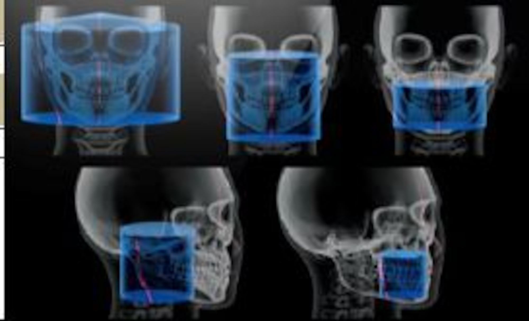 Kadena's 18th Dental Squadron has recently acquired a new x-ray unit that allows providers to view high resolution images of a patient's teeth, roots and jaws in 3-D. Cone Beam Computer Technology scans offer visibility of the smallest anatomical detail superior to conventional dental radiographs. The ability to view and manipulate images of patients in 3-D is unique to CBCT. (Courtesy photo)
