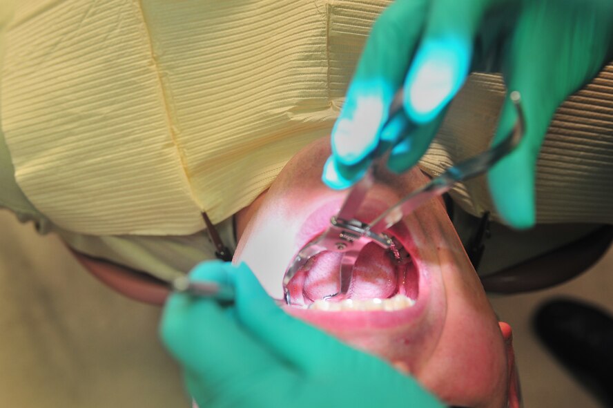 An Airman assigned to the 20th Security Forces Squadron, undergoes a routine dental checkup July 20, 2011, Shaw Air Force Base, S. C.  Shaw’s Dental Clinic is vital to mission readiness as all Airmen are required to have any dental issues taken care of prior to deployment. (U.S. Air Force photo by Airman 1st Class Ashley Gardner)(Released)