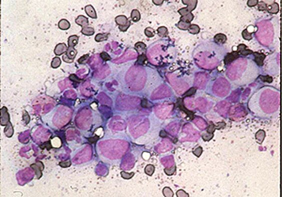 Air Force Academy officials announced July 26, 2011, that they are treating basic cadets and active-duty servicemembers for cases of gastroenteritis, or stomach flu. (photo courtesy of the Department of Veterans Affairs)