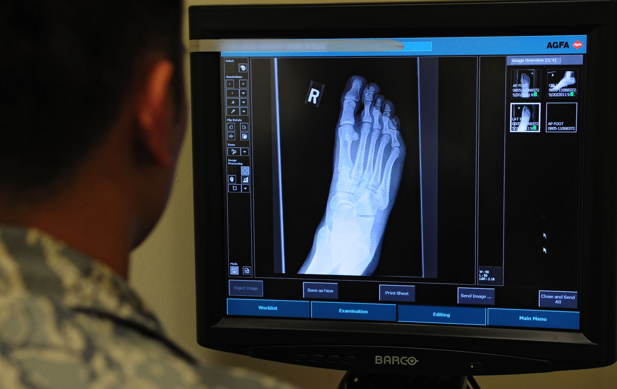 SPANGDAHLEM AIR BASE, Germany – Tech. Sgt. Mark Romera, 52nd Medical Support Squadron diagnostic ultrasound NCO in charge, reviews a patient’s X-ray and dictates the findings for the final report to the requesting physician here June 2. The X-ray will aid the doctors in diagnosing medical conditions the patient may have. (U.S. Air Force photo/Airman 1st Class Matthew B. Fredericks)