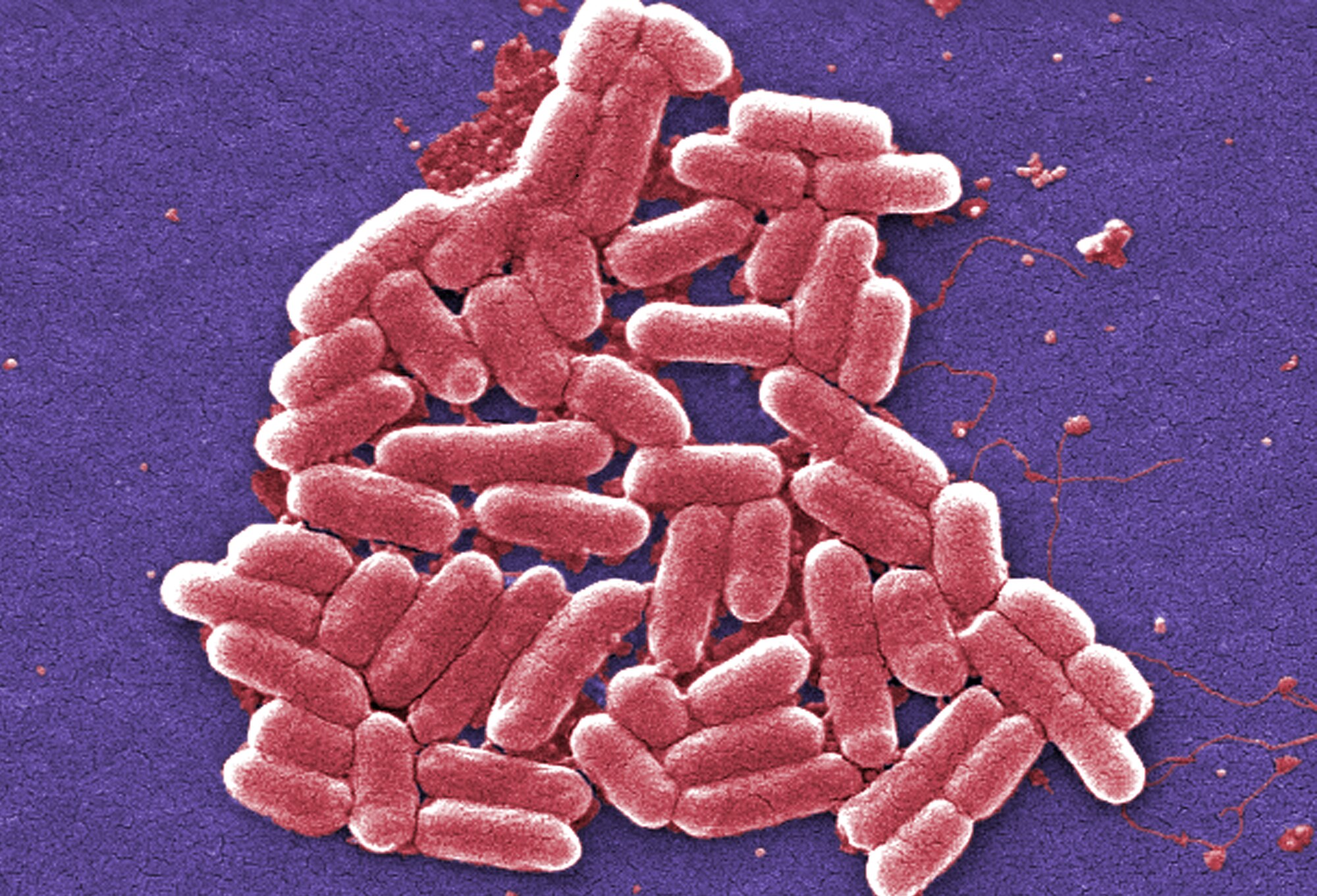 ROYAL AIR FORCE LAKENHEATH, England -- This colorized scanning electron micrograph depicts a number of E. coli bacteria. Due to the recent outbreak of E. coli in northern Germany, the Department of Defense has restricted the sale of European-procured lettuce, tomatoes, cucumbers and bean sprouts on base. There are no known cases among DOD or RAF Lakenheath personnel. (Centers for Disease Control and Prevention photo illustration/ Janice Haney Carr)