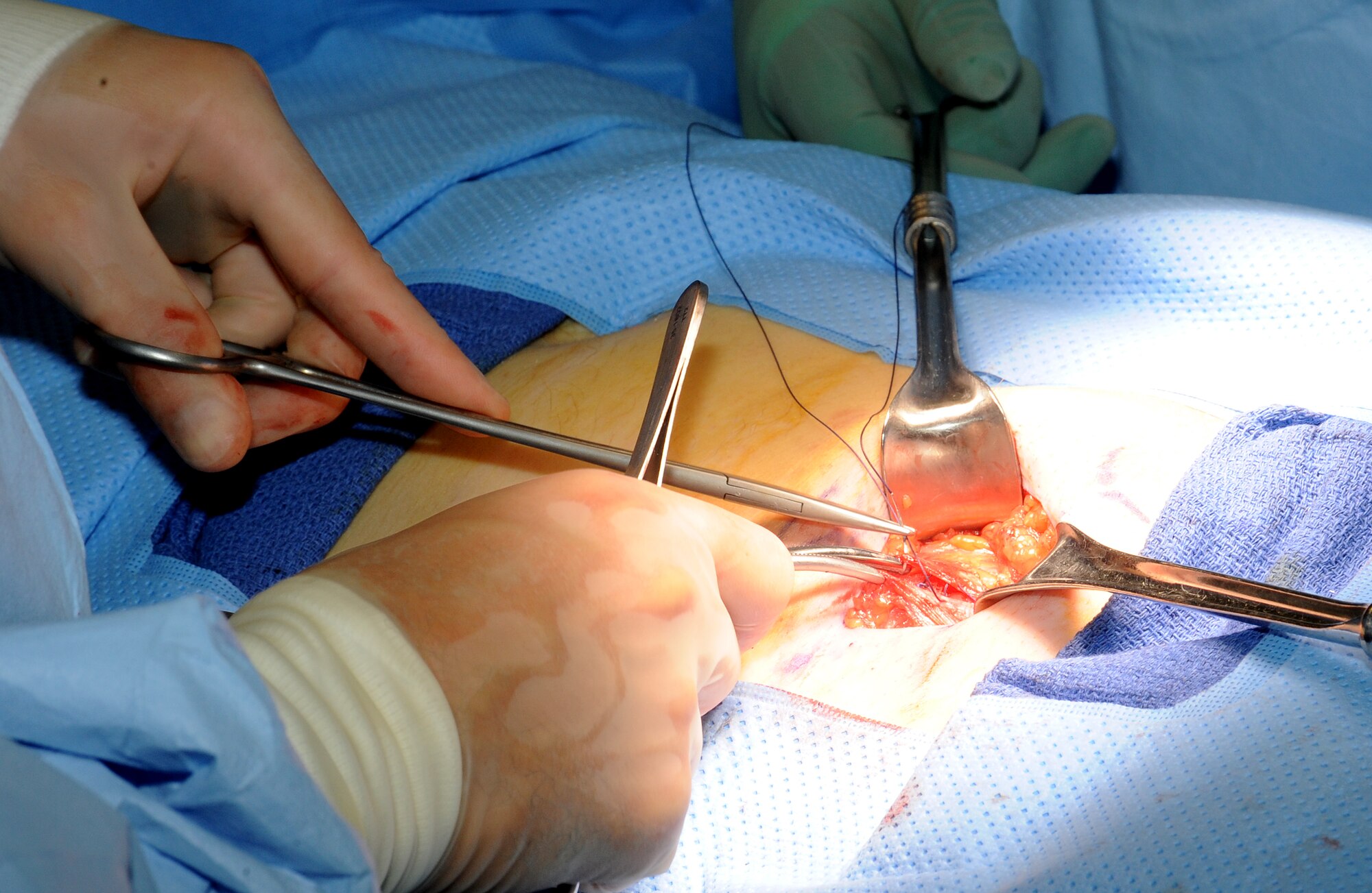 Dr. (Maj) Gustavo Lopes, general surgeon, closes the incision at the end of an inguinal hernia repair surgery at an undisclosed location in Southwest Asia, May 31. (U.S. Air Force photo/Staff Sgt. Liliana Moreno)                          