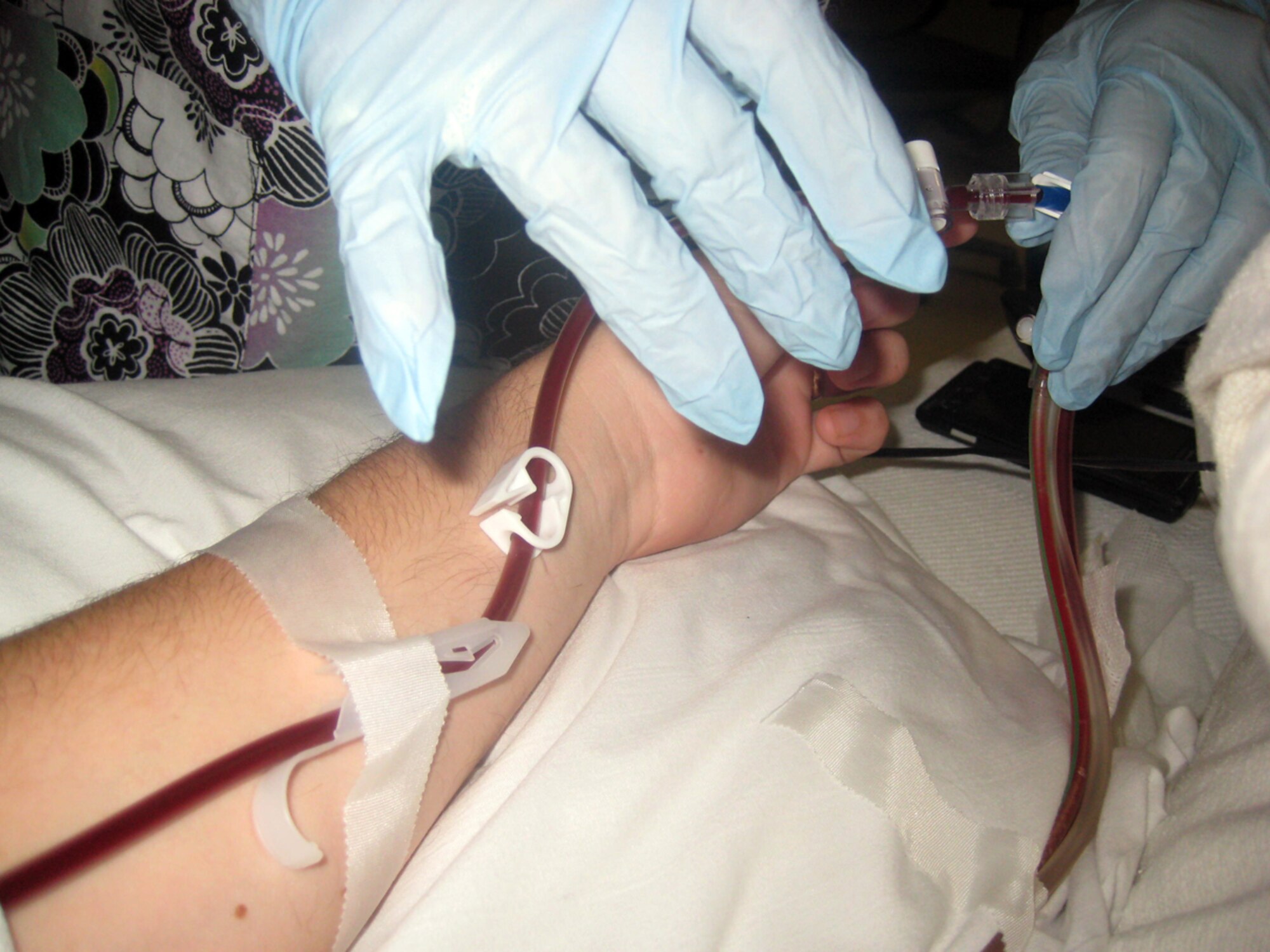 To collect peripheral bone marrow stem cells, the donation center pulls the donors blood from one arm where it is then ran through a centrifuge. After collecting the stem cells, the donor’s blood is returned via their other arm. (U.S. Air Force photo/Staff Sgt. Jacob Corbin). 