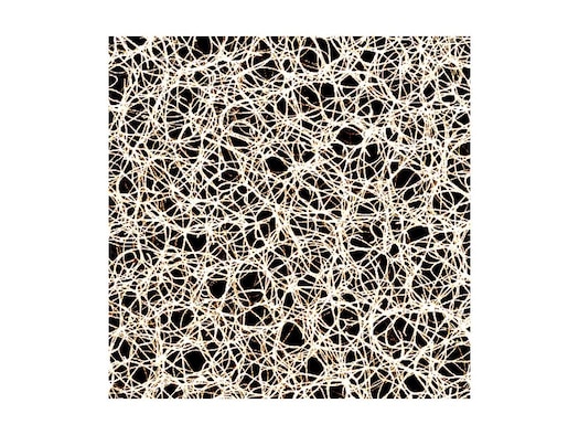 Confocal micrograph of an actin-filamin network. Credit: Kurt Schmoller, Technische Universtaet Muenchen (Technical University of Munich)
