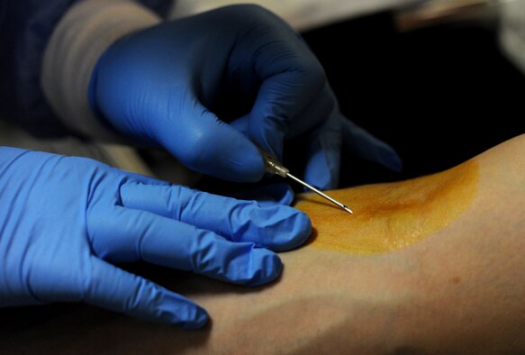 WHITEMAN AIR FORCE BASE, Mo. -- A needle is inserted into a blood donors arm during an Armed Services Blood Program blood drive March 16, 2011.  The blood collected will be used to care for deployed forces. (U.S. Air Force photo by Senior Airman Kenny Holston)(Released)

