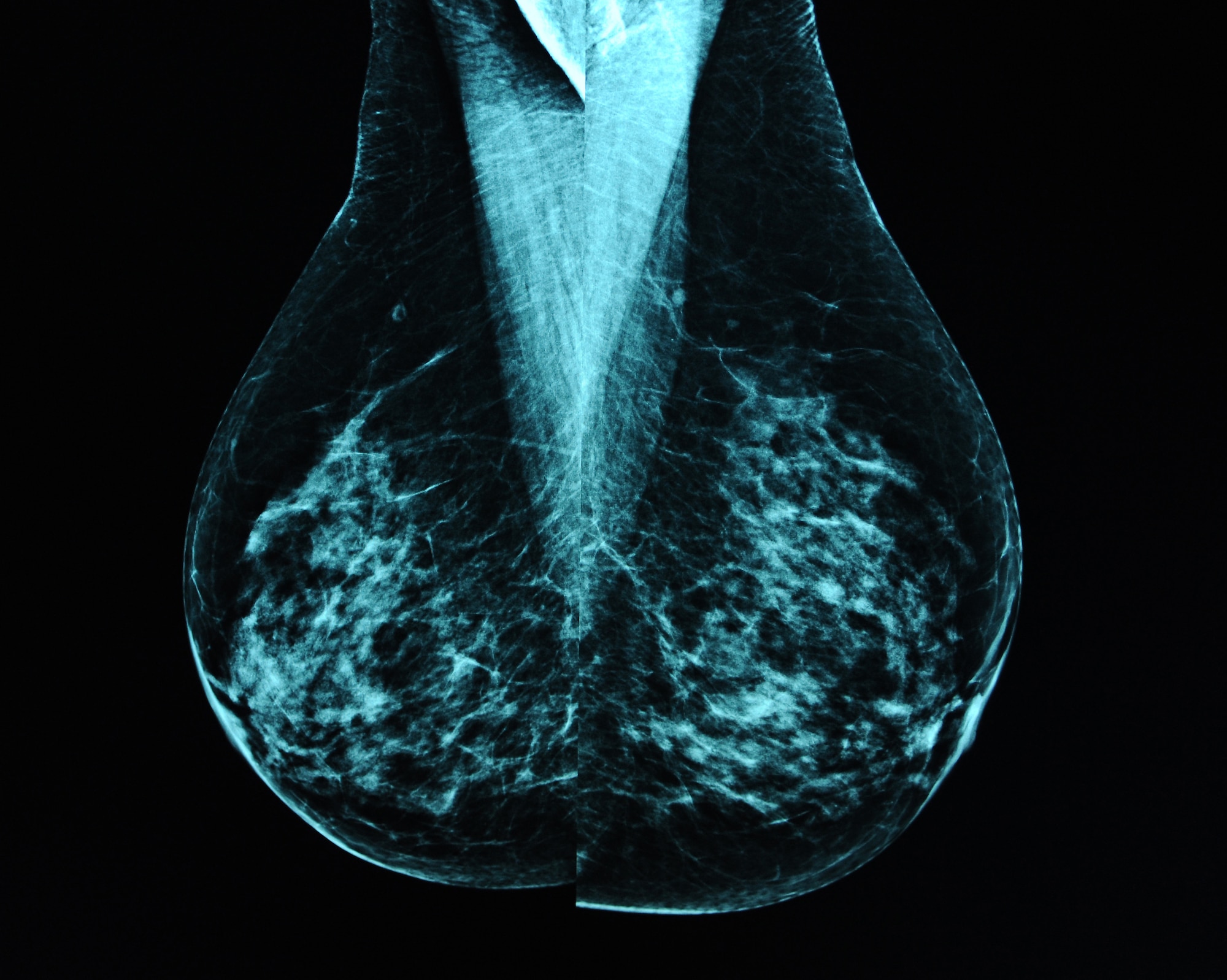 A mammographic image is displayed on state of the art mammography monitors at the David Grant USAF Medical Center. (U.S. Air Force photo/Staff Sgt. Liliana Moreno)
