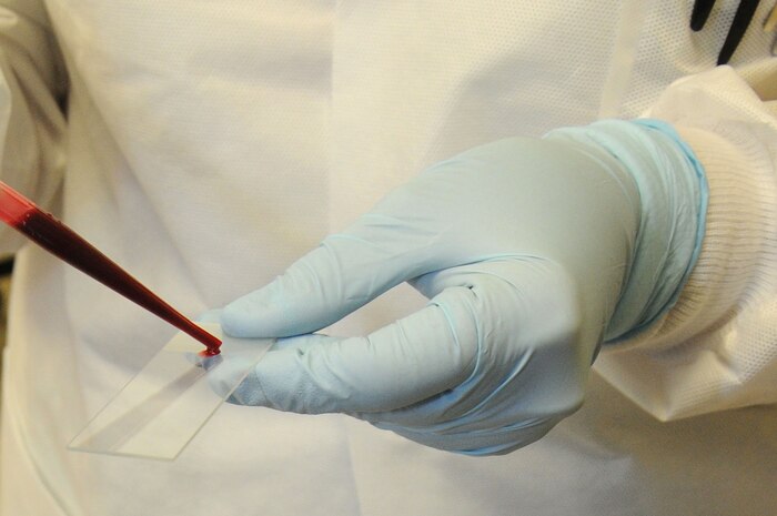 At the hematology lab, medical lab technician Lea Shoup uses an eye dropper to place a drop of blood onto a slide prior to viewing it through a microscope. This portion of the lab counts the number of white blood cells within each drop of blood. (U.S. Navy photo/Petty Officer 1st Class Jennifer Hudson)