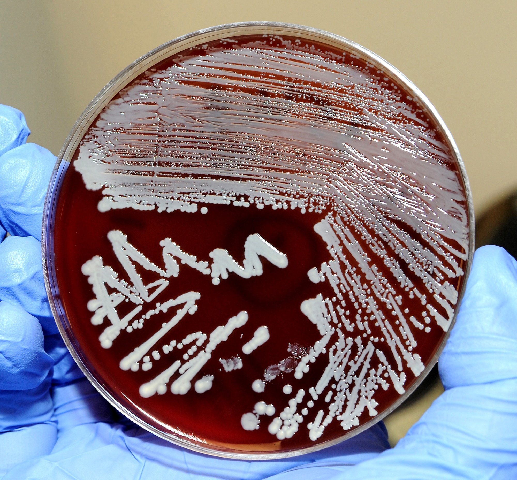 Staph bacteria growing on a culture plate. (U.S. Air Force photo/ Staff Sgt. Liliana Moreno)
