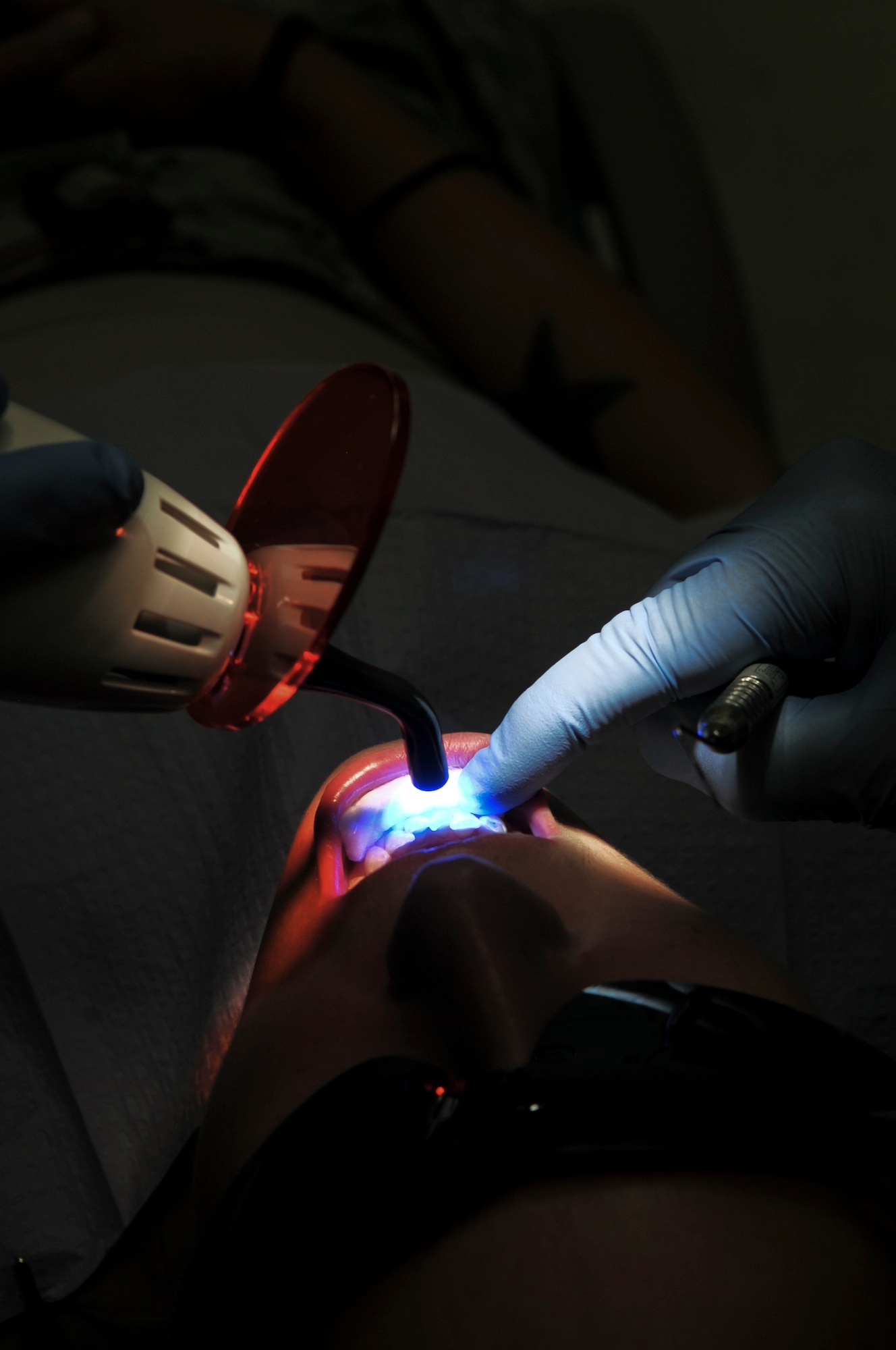 A patient receives treatment from a blue light curing unit to polymerize a filling Oct. 20, 2011, at an undisclosed location in Southwest Asia. Dental sick call hours are Monday - Saturday from 7 - 11 a.m. and noon to 4 p.m. on a walk-in basis. (U.S. Air Force photo/Senior Airman Paul Labbe)