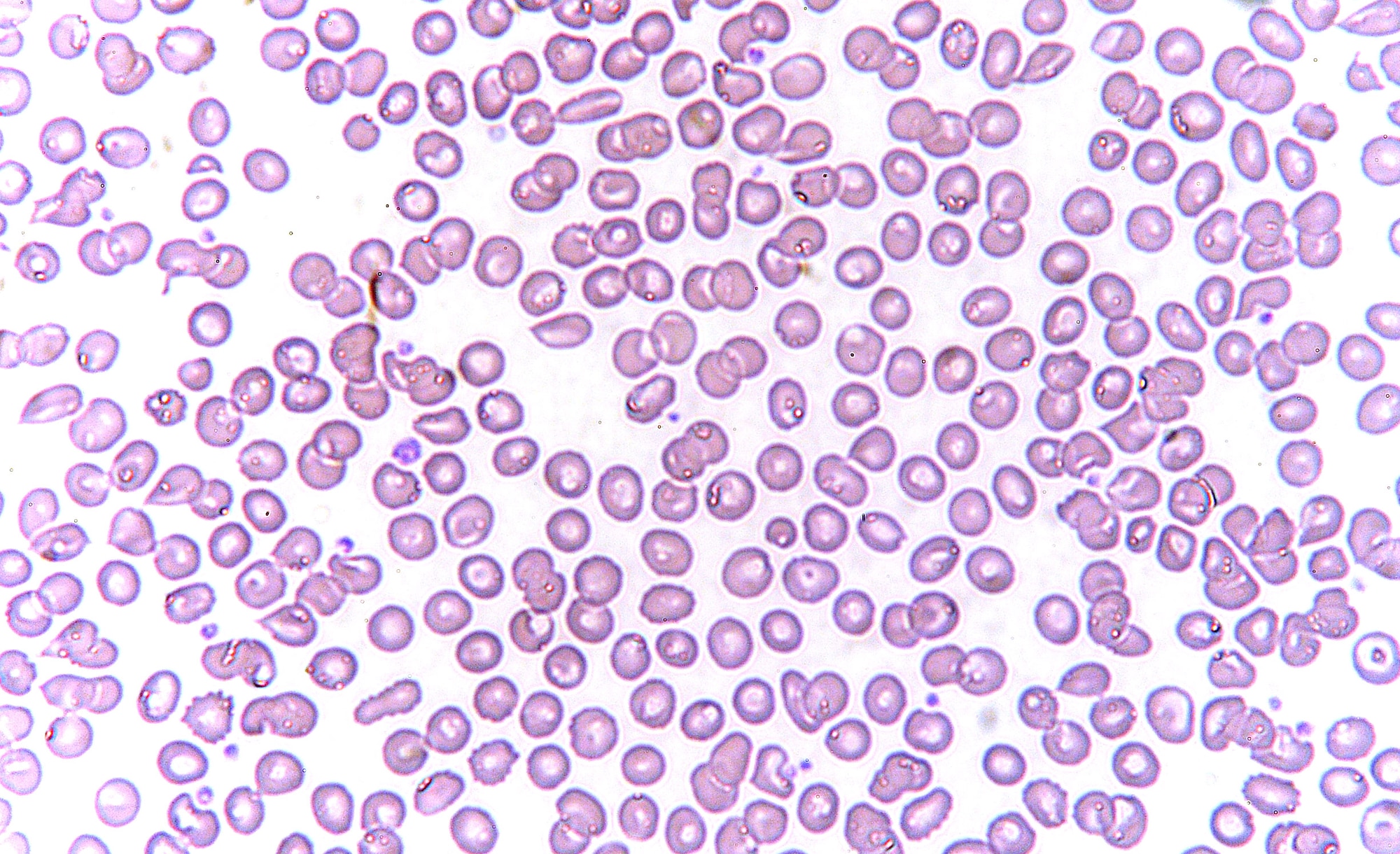 Red blood cells as seen at 50x magnification. The 18th Medical Support Squadron laboratory at Kadena Air Base, Japan, performs numerous tests on blood, bacteria, urine and stool samples in an effort to enhance patient care. (U.S. Air Force photo/Staff Sgt. Christopher Hummel)