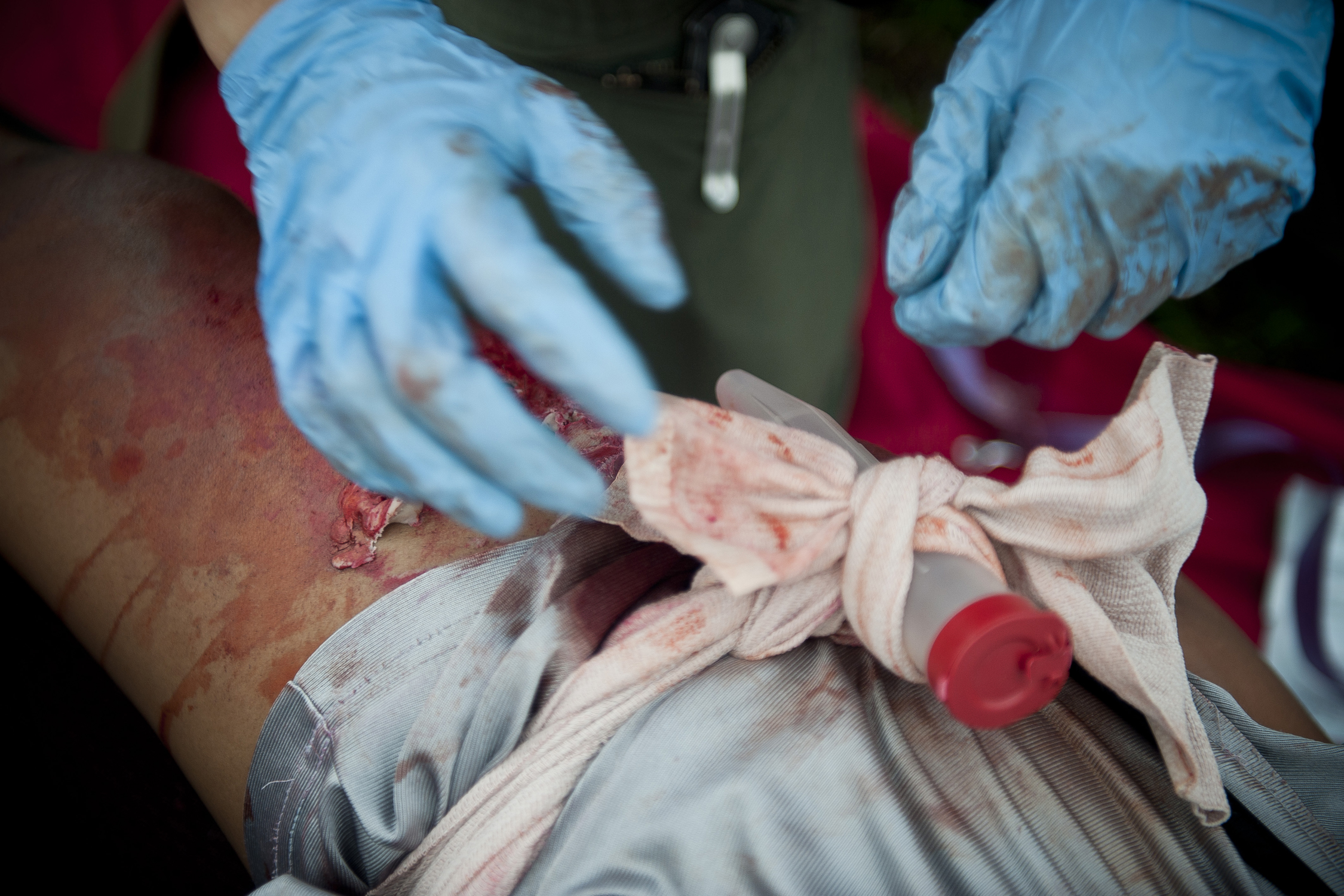 Applying A Tourniquet