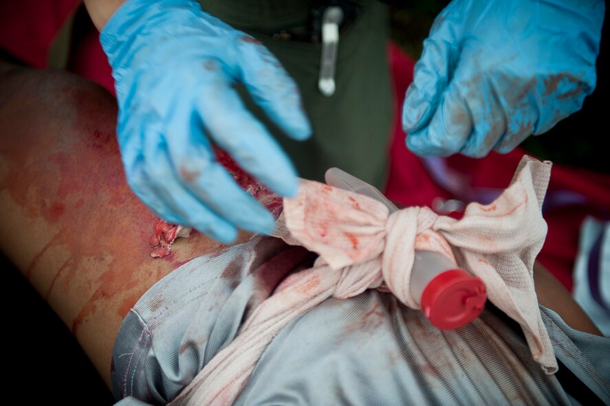 U.S. Air Force Capt. Susan Marchiano, 347th Operations Support Squadron flight surgeon, finishes applying an improvised tourniquet to the leg of Senior Airman Shatavia Wallace, 824th Base Defense Squadron fireteam member, during a mass casualty exercise Sept. 23, 2011, at Moody Air Force Base, Ga. Medics on scene categorized victims from most to least critical and treated them accordingly. (U.S. Air Force photo by Staff Sgt. Jamal D. Sutter/Released)    