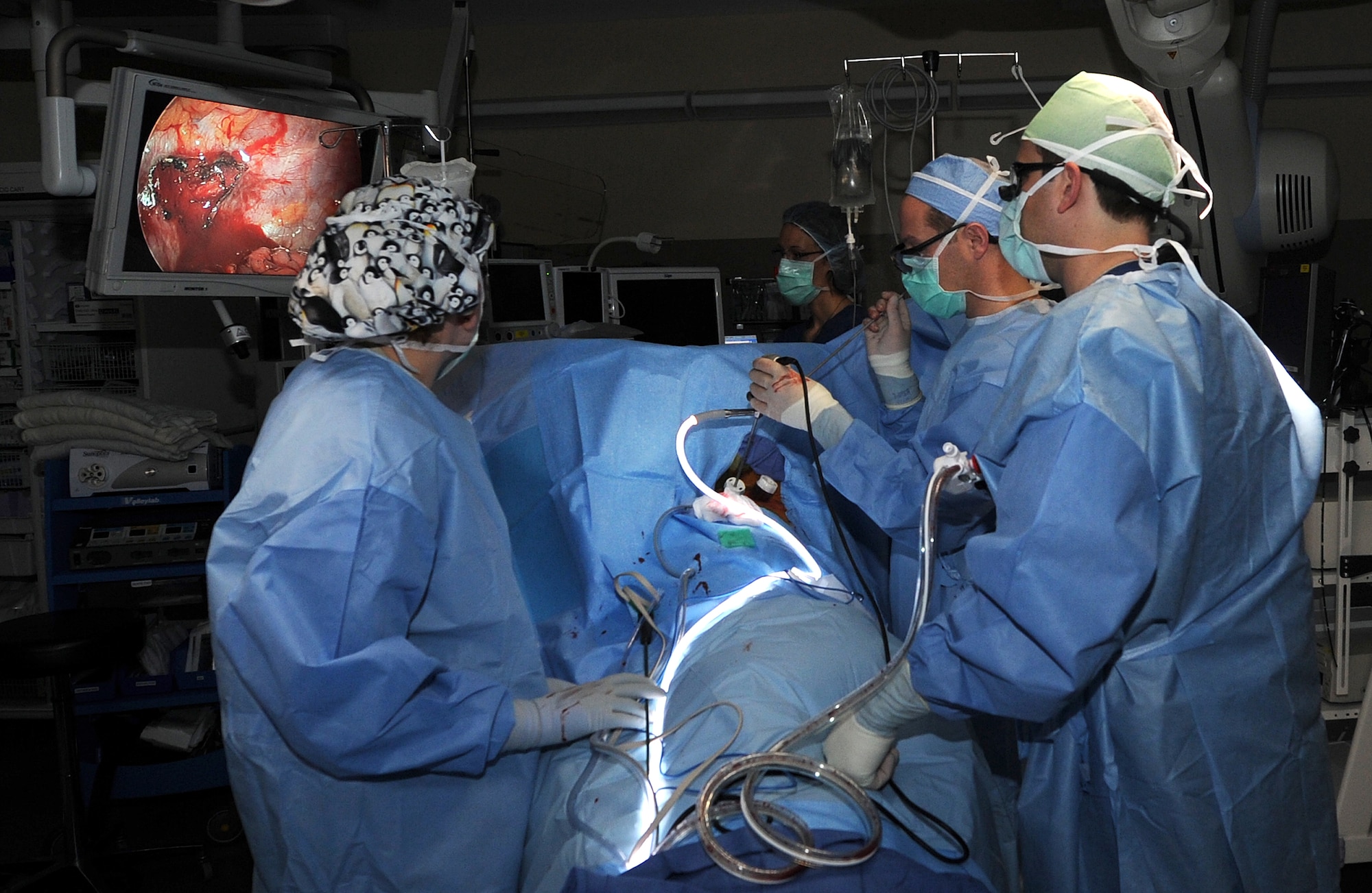 Lt. Col. (Dr.) B. Zane Atkins, center, 60th Surgical Operations Squadron chief or cardiothoracic surgery, performs video-assisted thoracosopic surgery March 27 at David Grant USAF Medical Center. He is assisted by Lance Hein, right, 60th MSGS physician assistant, and Senior Airman Cassandra Becker, 60th MSGS surgical technican. (U.S. Air Force photo/ Staff Sgt. Lilana Moreno)