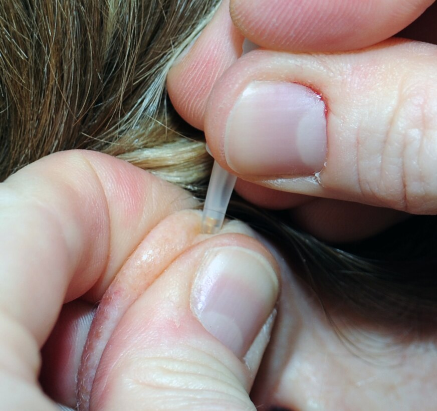 SOUTHWEST ASIA - Lt. Col. (Dr.) Darlene Smallman applies acupuncture needles to Maj. Amber Hirsch's ear April 4, 2012. Hirsch suffers from hip pain and has found acupuncture the only treatment that helps her. Smallman, a flight surgeon deployed to the 380th Air Expeditionary Wing from the Pentagon, studied at the Air Force Acupuncture Center on Joint Base Andrews, Md. Hirsch is the wing judge advocate. (U.S. Air Force photo/Staff Sgt. J.G. Buzanowski)
