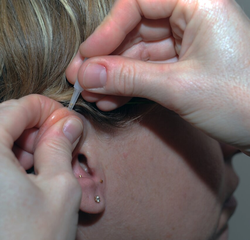 SOUTHWEST ASIA - Lt. Col. (Dr.) Darlene Smallman applies acupuncture needles to Maj. Amber Hirsch's ear April 4, 2012. Hirsch suffers from hip pain and has found acupuncture the only treatment that helps her. Smallman, a flight surgeon deployed to the 380th Air Expeditionary Wing from the Pentagon, studied at the Air Force Acupuncture Center on Joint Base Andrews, Md. Hirsch is the wing judge advocate. (U.S. Air Force photo/Staff Sgt. J.G. Buzanowski)