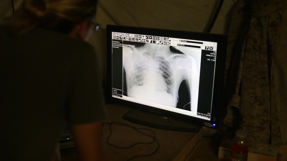 Lt. Nicole Lunceford, an emergency medicine physician with the Shock Trauma Platoon, Surgical Company, 1st Maintenance Battalion (-) Reinforced, 1st Marine Logistics Group (Forward) examines a chest X-Ray from a patient at the STP on Forward Operating Base Edinburgh, Afghanistan, April 10. For approximately three hours, the medical personnel completed blood transfusions, numerous X-Rays, three surgeries, fragment extractions and other medical procedures after an incident in nearby Musa Qa’lah in Helmand Province sent 11 critically wounded patients to the STP/FRSS.