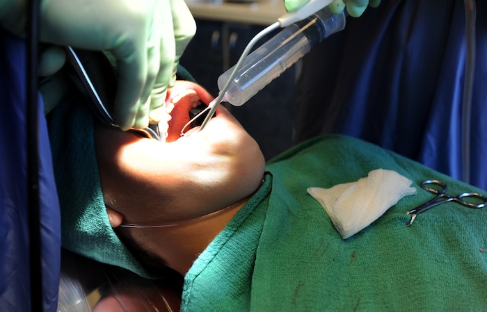 Capt. Aaron Cohenour, with help from dental assistant Tanya Maisonet, performs a wisdom tooth extraction on Senior Airman Chaley Dyer at Joint Base Charleston - Air Base April 11. Cohenour and Maisonet are from the 628th Medical Group and Dyer is from the 628th Security Forces Squadron. (U.S. Air Force photo / Airman 1st Class Ashlee Galloway)
