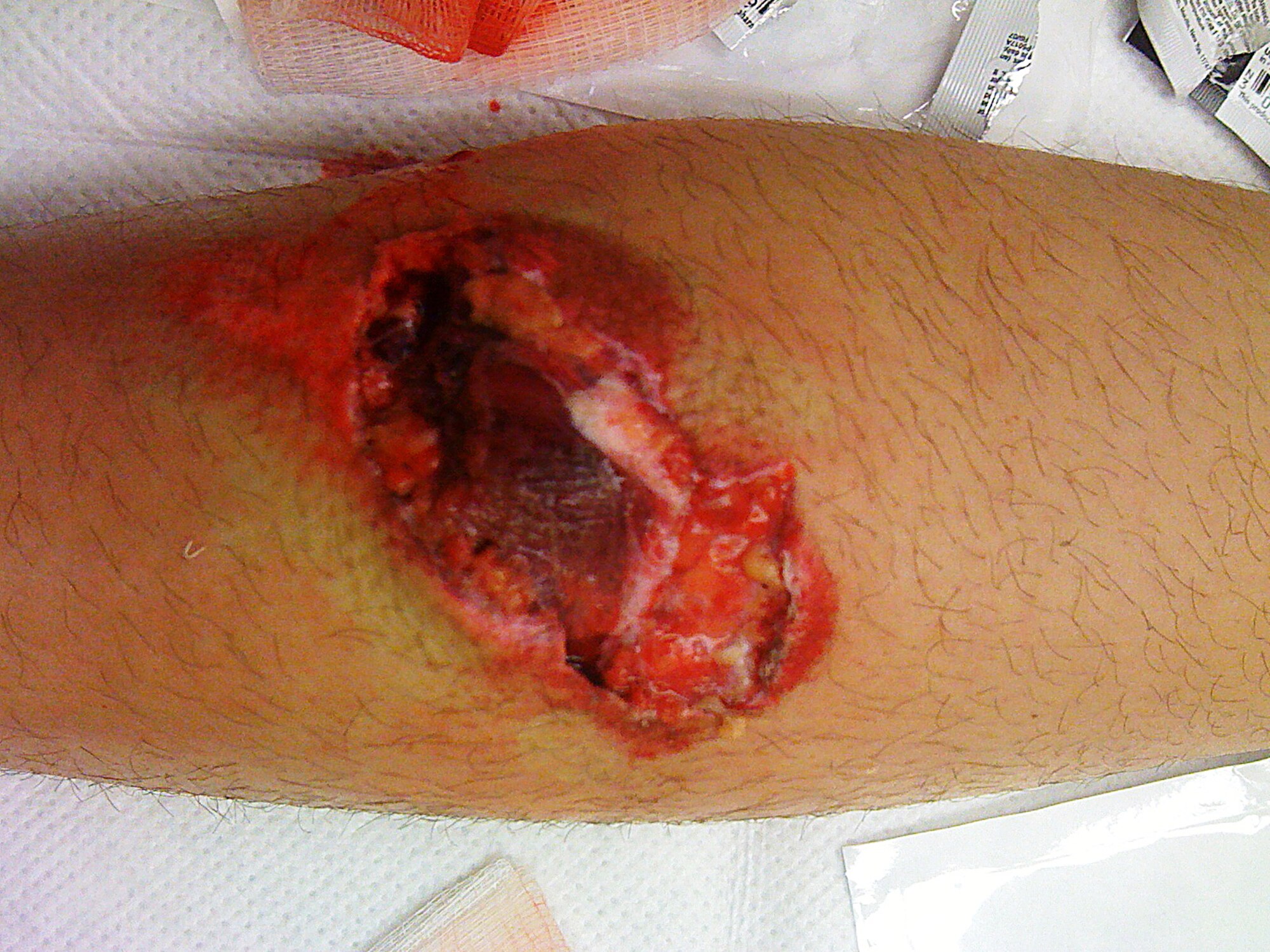 Airman 1st Class James Kirshner, 377th Security Forces Squadron, Kirtland, AFB, N.M., wound up with a leg laceration from the bike peg when he hit a deep rut while riding his dirt bike. An experienced rider, Kirshner wore proper protective gear and was riding with friends at the time of the accident. His advice to fellow riders is stay within your skill level, pay attention to the surroundings and anticipate what’s around the next turn or at the top of a hill.