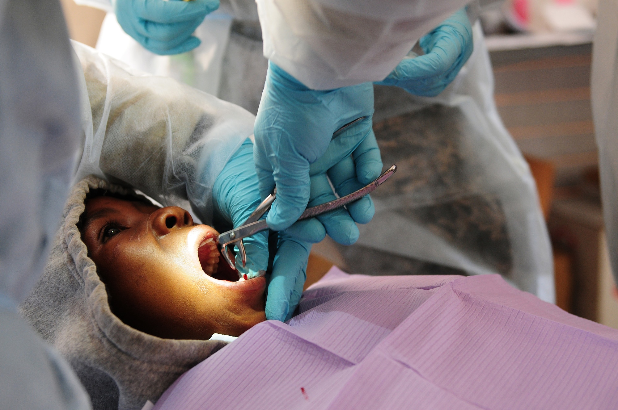 THEBEPHATSWA AIR BASE, Botswana -- Phenyo Thotsa, 12, has a tooth pulled during a humanitarian civilian assistance at Malwelwe village, Aug. 7, 2012. The HCA was provided by MEDLITE/SOUTHERN ACCORD 12, a key element in a broader series of military-to-military activities that demonstrate the strong partnership between the U.S. and BDF forces. (U.S. Air Force photo/Senior Airman Lausanne Morgan)