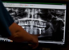 Senior Airman Tara Serrano, 628th Medical Group dental assistant, examines an X-ray of a patient’s mouth Aug. 17, 2012, at Joint Base Charleston - Air Base, S.C. Dental assistants aid dentists in the performance of generalized tasks, including chair-side aid, clerical work, reception and some radiography and dental laboratory work. (U.S. Air Force photo/Airman 1st Class Ashlee Galloway)