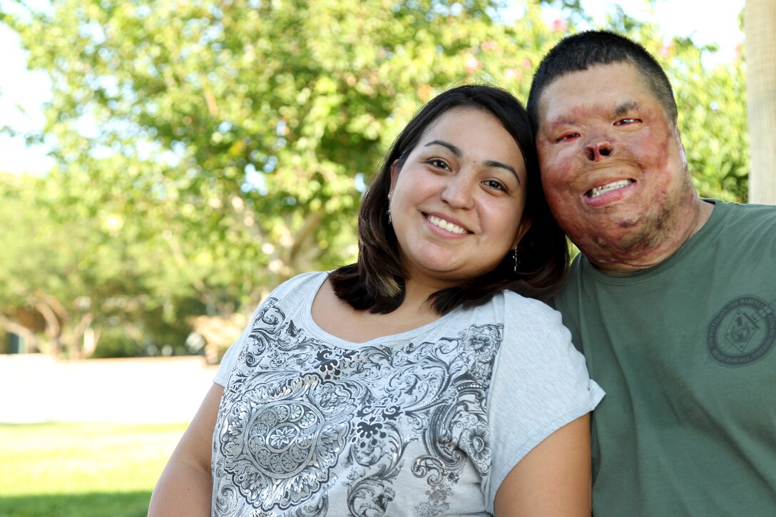 Retired Cpl. Anthony Villarreal and his wife, Jessica, have been married for five years. More than half that time has been spent helping Anthony readjust to life after a June 2008 run-in with an improvised explosive device took out away one of his arms, all of his remaining fingers and more than 80 percent of his skin.