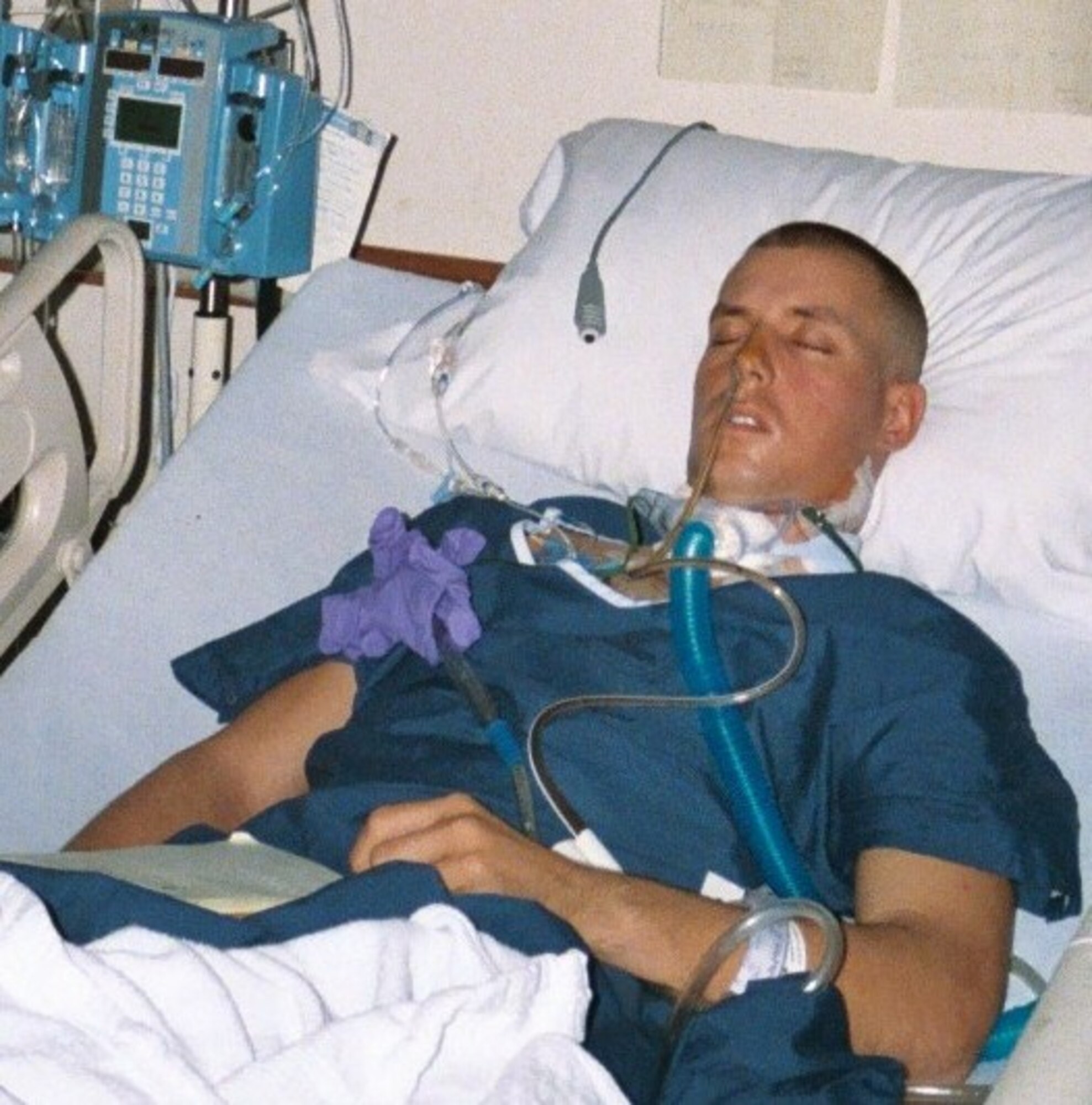 Former Marine Sgt. Brian Sellers lies in a hospital bed at Landstuhl Regional Medical Center, Germany after surviving the mortar explosion that wounded him while deployed to Iraq. The shrapnel from the explosion resulted in Sellers losing 70% of the use of his tongue. (courtesy photo)