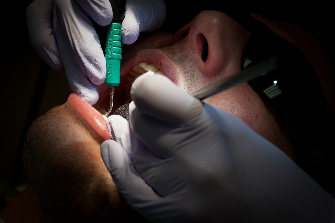 Senior Airman Taylor Johnson, 28th Medical Operations Squadron dental assistant journeyman, uses an ultra-sonic cavitron on Staff Sgt. Andy Weaver, 28th Communications Squadron client service technician, during an annual cleaning in the dental clinic at Ellsworth Air Force Base, S.D., Feb. 7, 2012. The tool uses air and water to remove hard deposits and flush away plaque to ensure oral hygiene, keeping Airmen healthy and fit to fight. (U.S. Air Force photo by Airman 1st Class Kate Thornton/Released)