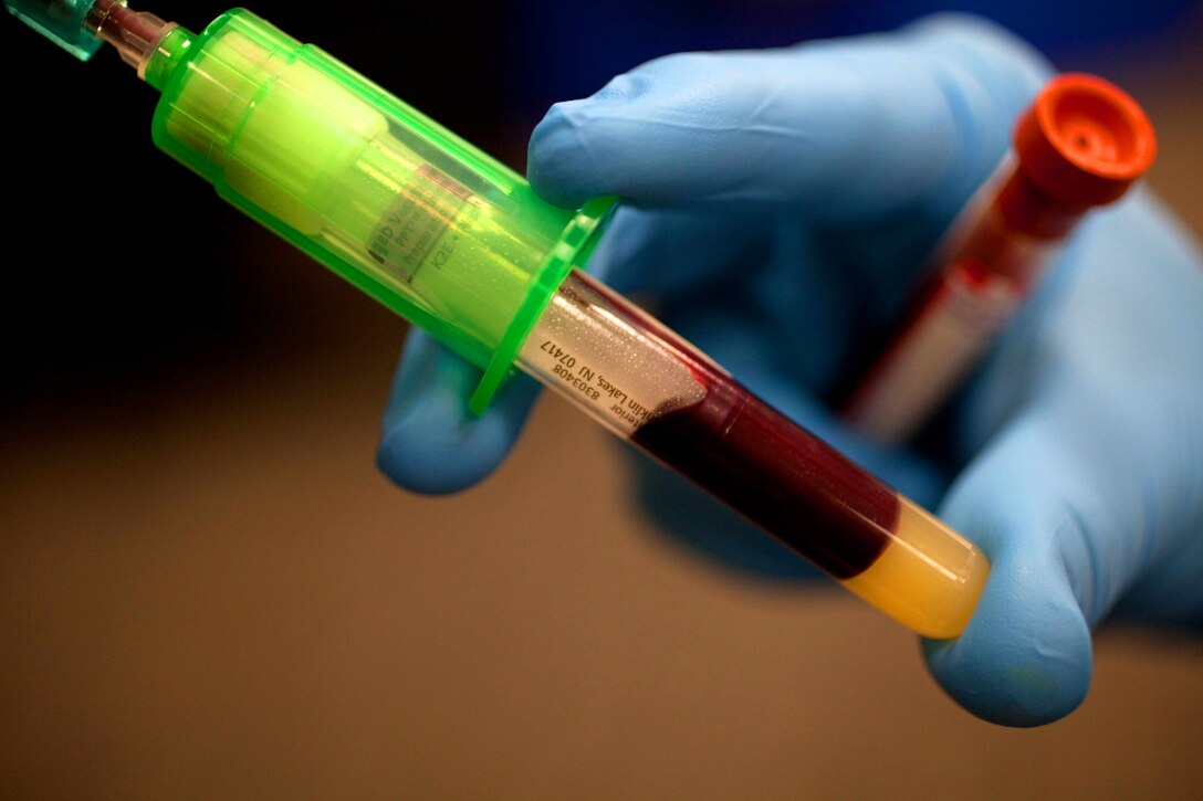 CAMP H. M. SMITH, Hawaii -During the blood collection process, medical personnel gather additional blood samples to test for an array of blood disorders and communicable diseases. Every unit of blood is rigorously tested before approved for transfusion into a patient.