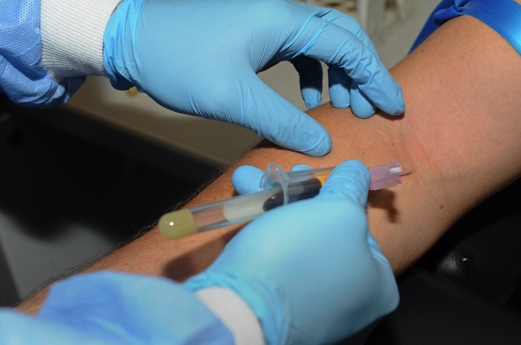 SPANGDAHLEM AIR BASE, Germany – A 52nd Medical Support Squadron laboratory technician draws blood from a patient at the clinic here Jan. 10. The laboratory technicians collect and test urine and blood samples for the diagnosis, treatment and prevention of diseases. These preventative measures help physicians provide the best possible healthcare to Saber Airmen and their families, retirees and Department of Defense employees. (U.S. Air Force photo/Airman 1st Class Matthew B. Fredericks)