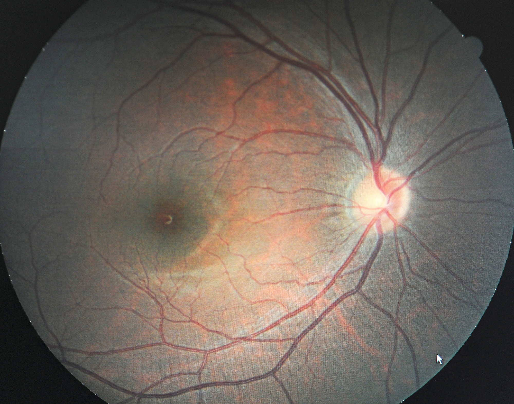 An image taken of the optic nerve is used as a screening tool in the clinic to get a fast overview of any pathological alterations in the retinal layers. (U.S. Air Force photo/ Staff Sgt. Liliana Moreno)