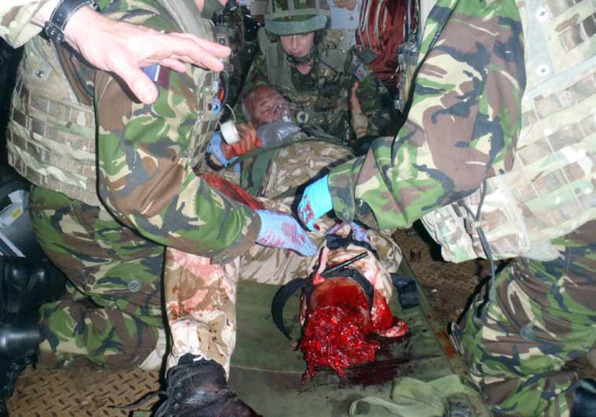 During Royal Air Force Reserve exercise, Serpent Rise 12 held from May 12 to 26, British exercise organizers used actual amputees to depict injured personnel in disaster scenarios. Shown is one of the actors hired to participate in the exercise .  (U.S. Air Force photo)
