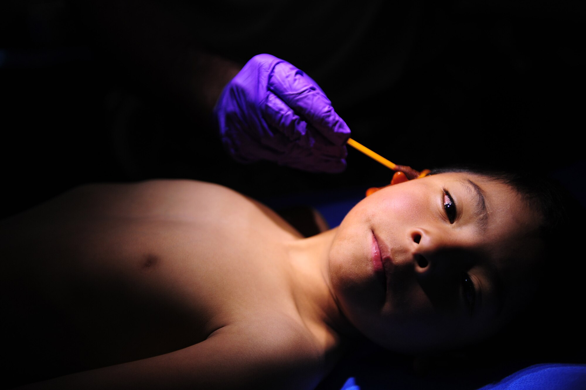 A doctor disinfects a Peruvian boy's ear before beginning surgery to remove a cyst at an Expeditionary Medical Support mobile field hospital in Huancavelica, Peru, July 2, 2012, during New Horizons 2012. New Horizons is a U.S. Southern Command-sponsored annual series of joint humanitarian assistance exercises deploying U.S. military engineers, veterinarians, medics and other professions to Central and South American nations for training, construction projects, and to provide humanitarian and medical services. (U.S. Air Force photo by Staff Sgt. Michael C. Zimmerman/Released)