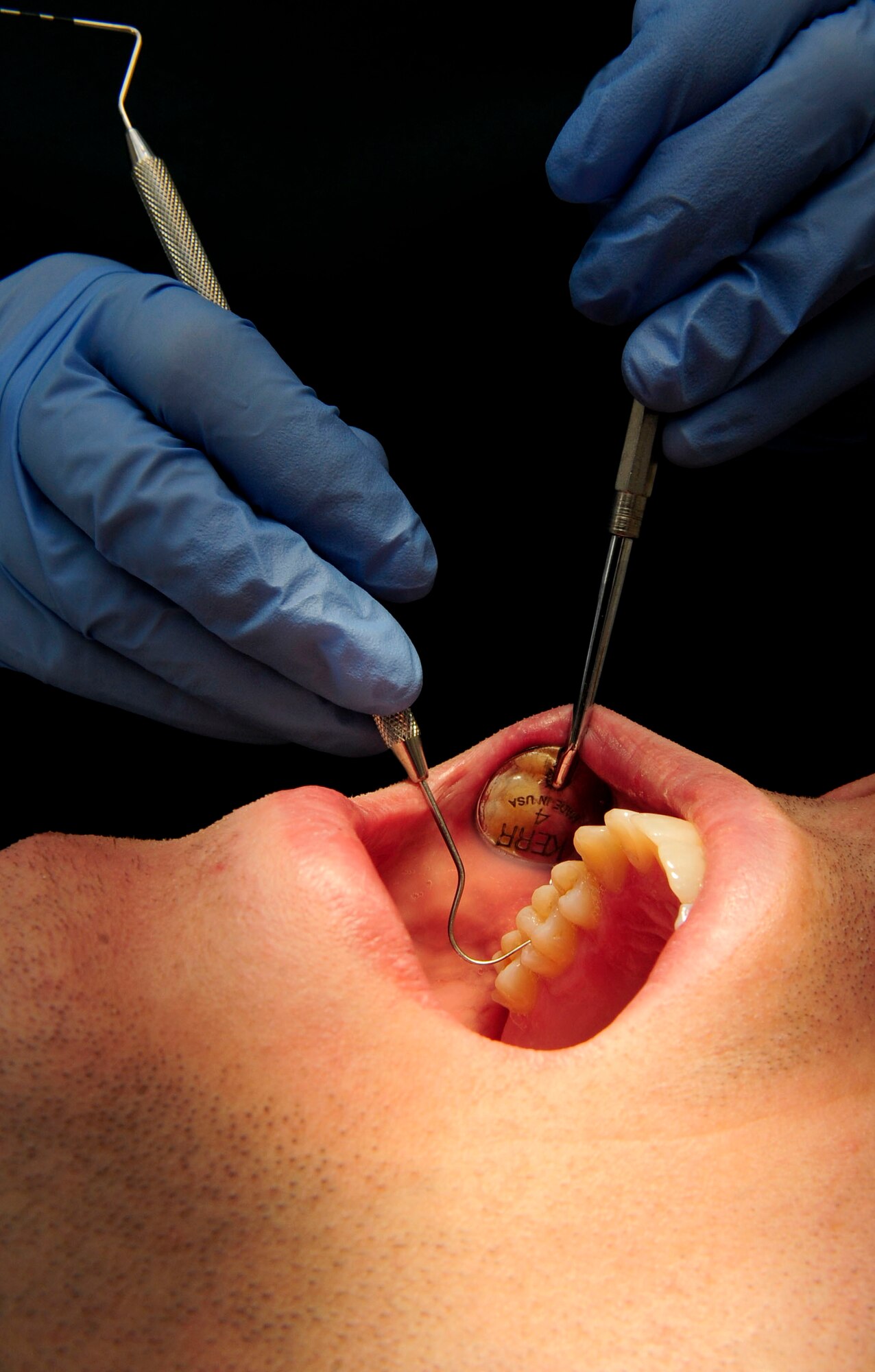 An Explorer is used to check for cavities in a routine exam during an internal training exercise at RAF Mildenhall July 30, 2012.  Dentist use the Explorer, along with many other tools, to ensure that they can perform a thorough examination or cleaning. (U.S. Air Force photo Senior Airman Ethan Morgan)