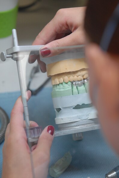 U.S. Air Force Senior Airman Jennifer Baer, 18th Dental Squadron dental lab technician, examines how a dental bridge fits onto a clay cast of teeth on Kadena Air Base, Japan, June 11, 2012. A bridge is a dental restoration to replace a missing tooth by bridging the gap with a gold restoration or a porcelain tooth. The average number of products the Area Dental Lab puts out a week totals 50 units. After personnel cuts were made in 2009, the Area Dental Lab on Kadena went from a team of 22 Airmen down to 12 Airmen. Along with providing different dental products to active-duty members on Kadena, the ADL also provides units to other military bases in the pacific region in order to keep all active-duty members mission ready. Some bases include Osan Air Base, Korea and Misawa Air Base, Japan. For the ADL, their peak busy season is during the summer months while service members get ready to change duty stations. (U.S. Air Force photo/Airman 1st Class Hailey R. Davis)