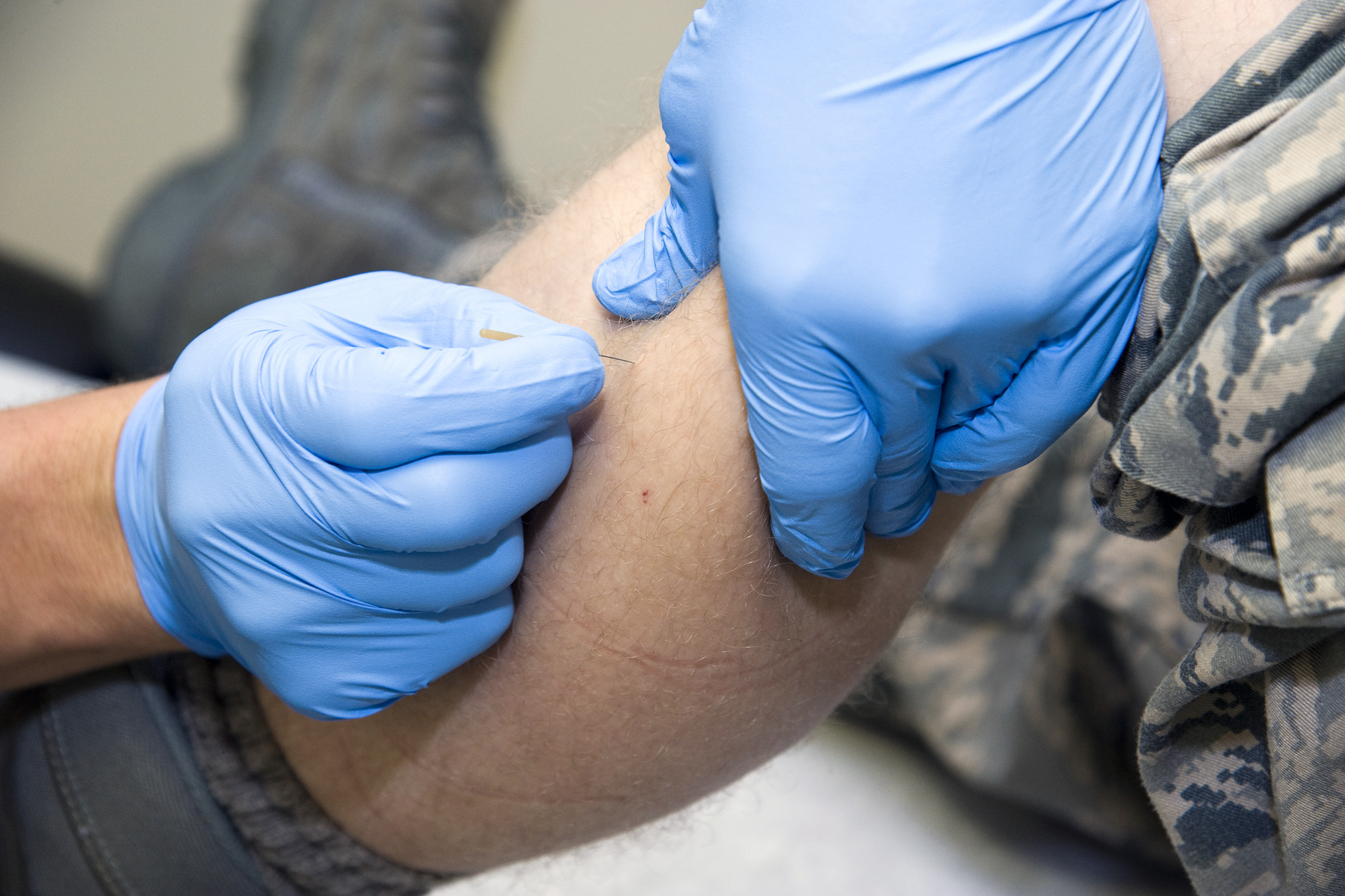 Medical group therapeutic dry needling